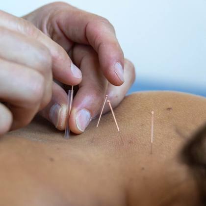 Orthopädische Akupunkturbehandlung in der Praxis Dr. Güth, Offenburg